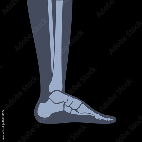 Human Normal Bones