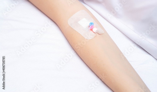 A venous catheter on the arm of a female patient on a white background. The concept of injecting drugs with a catheter. Copy space for text