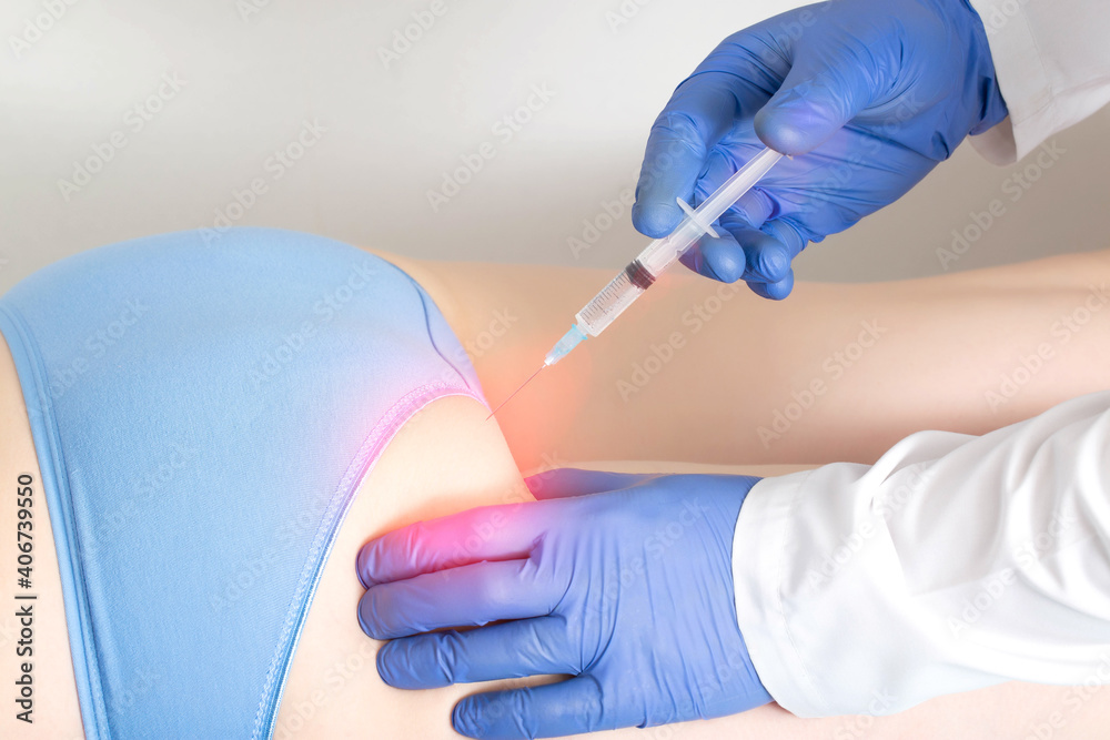 The doctor makes the patient a medication blockade in the area of the sciatic nerve buttocks. Concept of a complex of medicinal products in a drug blockade to eliminate pain and inflammation of the The doctor makes the patient a medication blockade in the area of the sciatic nerve buttocks. Concept of a complex of medicinal products in a drug blockade to eliminate pain and inflammation of the