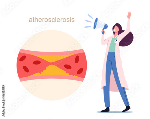 Medic Character Yell to Megaphone near Blood Vessel Blocked with Cholesterol Plaque. Doctor Alert of Atherosclerosis