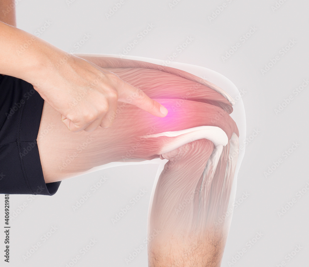 Naklejka premium thigh muscle inflammation feel pain