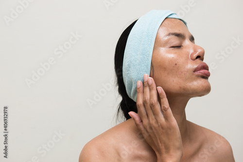 woman with very oily skin photo
