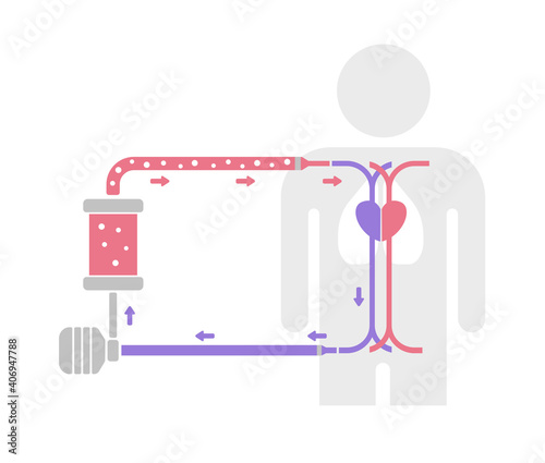 ECMO ( Extracorporeal membrane oxygenation ) structure vector illustration / no text