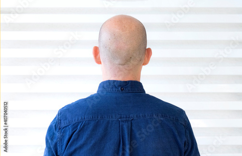 Person without hair on his back with blue shirt and white background