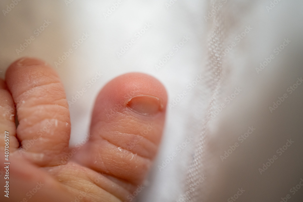 新生児の足の親指 新生児の足の親指