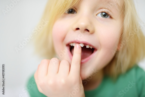 Portrait of boy shaking wobbly milk tooth in open mouth before it changes to the molar. Stages of growing up a child. Health care and dental hygiene for baby. photo