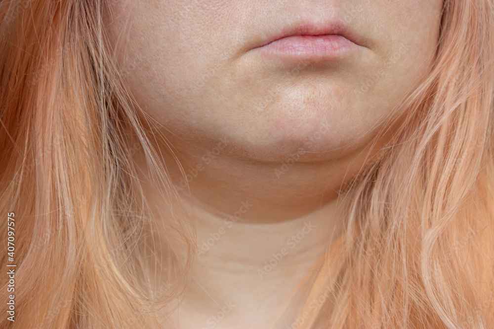 Close-up portrait of a girl with orange hair without makeup and skin retouching. Close-up portrait of a girl with orange hair without makeup and skin retouching.
