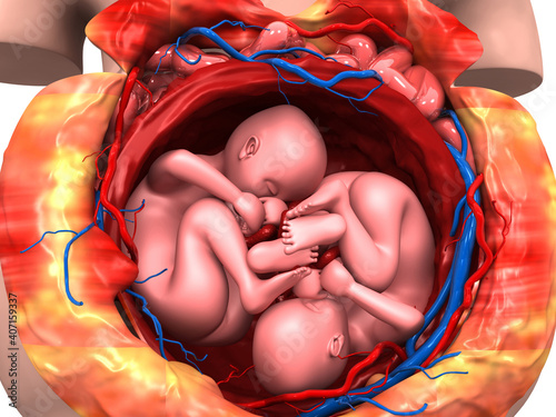 Twin fetus in womb. 3d illustration.. photo