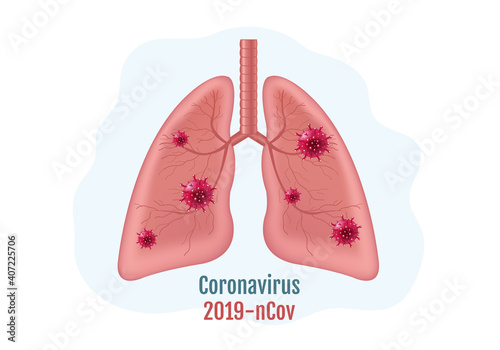 Lungs Human Internal Organ With Coronavirus Isolated White Background With Gradient Mesh, Vector Illustration
