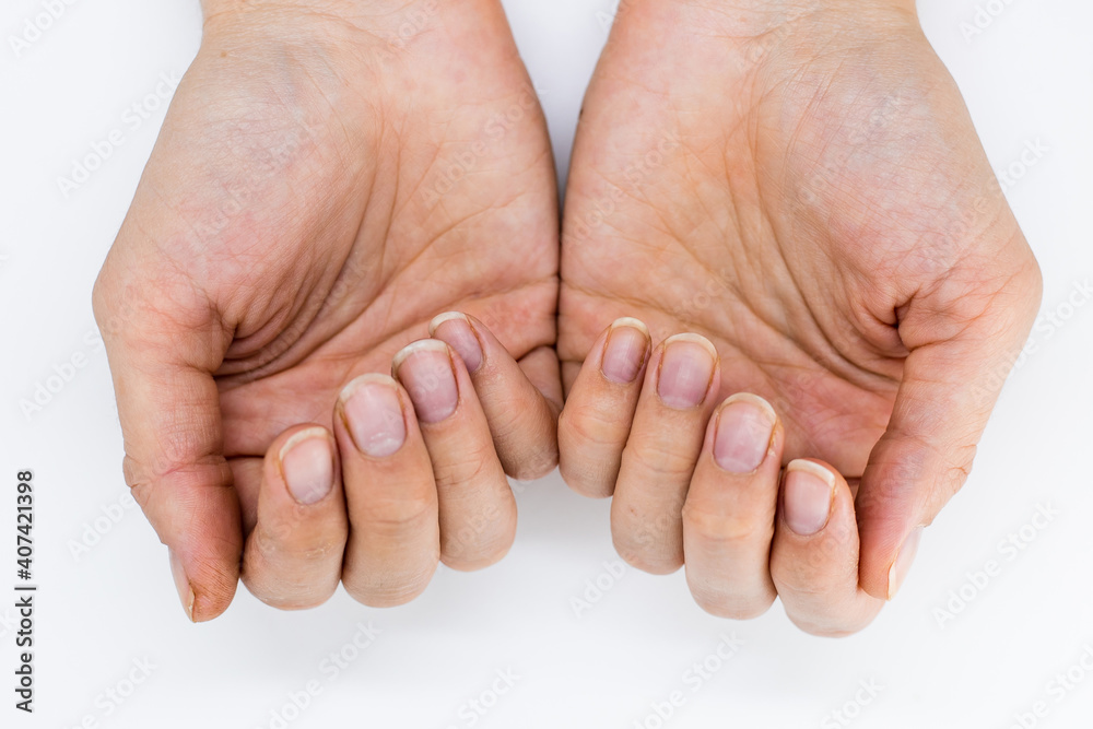 Women's hands without manicure on nails on a white background