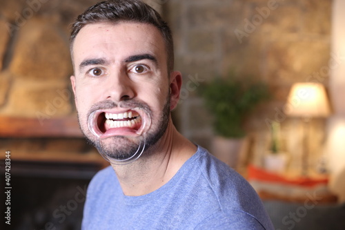 Man using dental plastic mouth opener