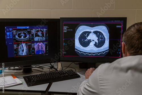 Computed tomography of the chest with Covid-19. X-ray and computed tomography room in a Russian polyclinic in Moscow. The doctor analyzes the image on the computer to obtain a diagnosis.