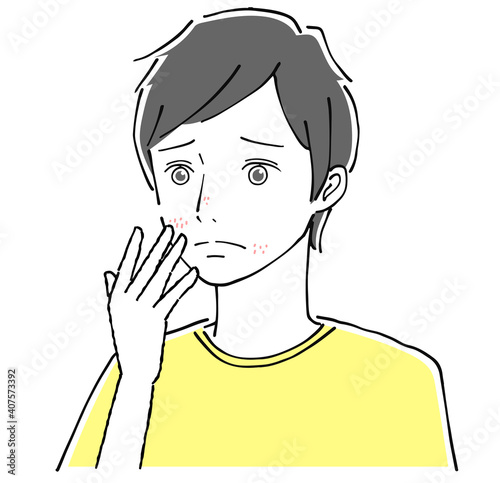 肌荒れする男性
