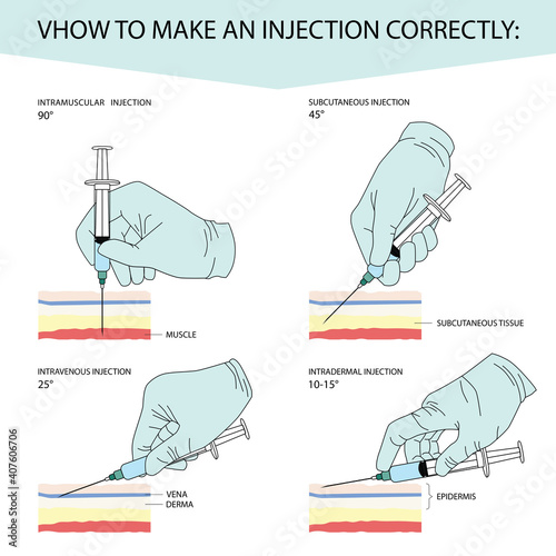How to make an injection correctly. Infographics for different types of injections. A gloved hand with a syringe. Vector illustration isolated on a white background for design and web.