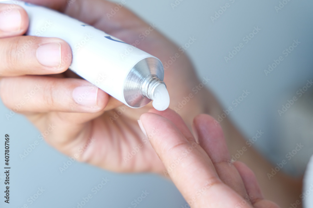 The woman's hand, she uses steroids Apply External type The woman's hand, she uses steroids Apply External type