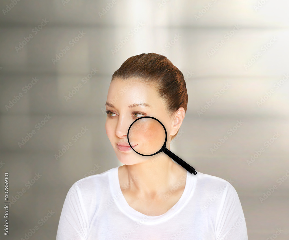 Dark spots, freckles,hyperpigmentation(melasma or chloasma),concept - skin lightening, skin whitening, fruit acids,AHA, Skin Brightening. Dark spots, freckles,hyperpigmentation(melasma or chloasma),concept - skin lightening, skin whitening, fruit acids,AHA, Skin Brightening.