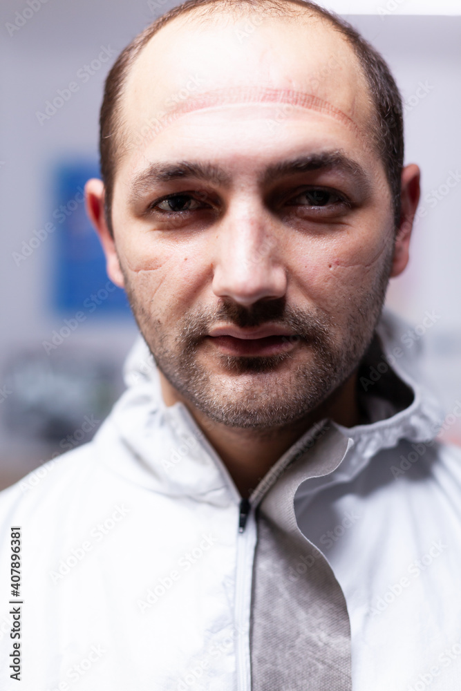 Fototapeta premium Close up of exhausted pediatric dentist man marks on face because of protection mask. Portrait of tired stomatologist wearing coronavirus ppe suit looking at camera.