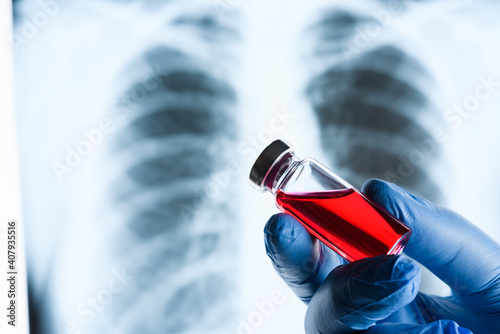 Vaccine against the virus. Doctor's hand holding an ampoule with red medicine on the background of a fluorographic picture photo