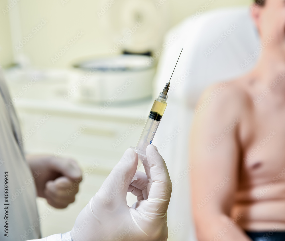 Platelet-Rich plasma preparation. Syringe with plasma in hands Platelet-Rich plasma preparation. Syringe with plasma in hands