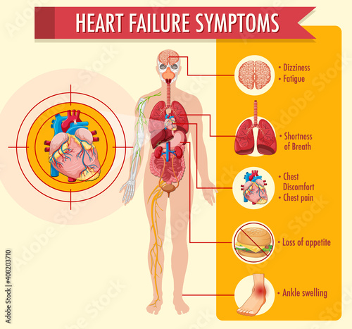 Heart failure symptoms information infographic