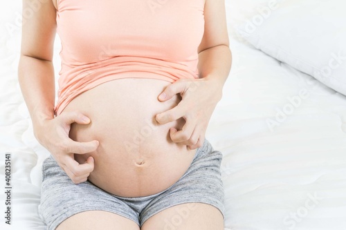 Pregnant woman scratching belly because itchy skin which causes striped- Pregnancy medicine concept.