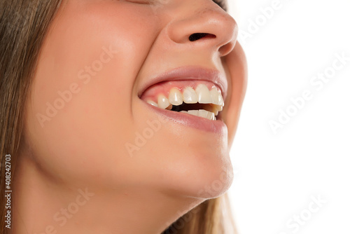 Closeup of a young woman s toothy smile