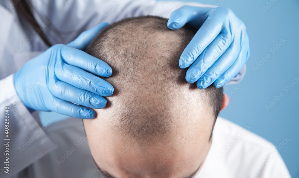 Doctor hands on patient head. Hair growth Doctor hands on patient head. Hair growth