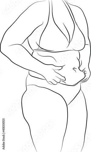Woman with obesity holding her belly fat