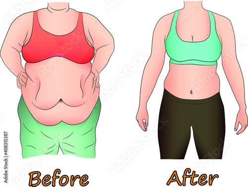 Abdominal fat of a woman before and after dieting, sport or surgery