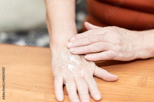 An elderly woman smears her hands with cream. A woman's hands with close-up cream. © nadezhda