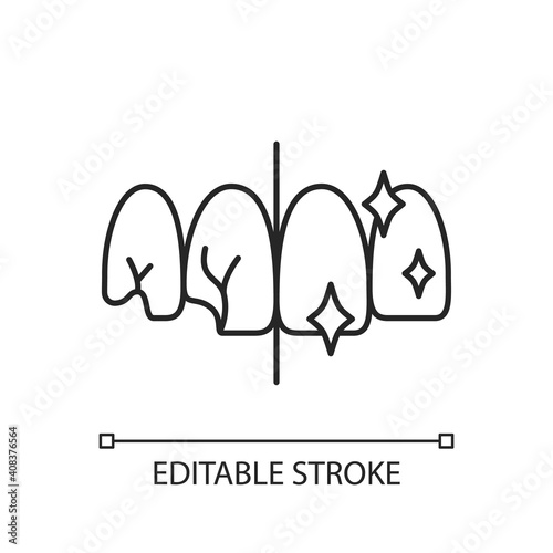 Tooth restoration linear icon. Dental procedures. Professional oral care. Cosmetic dentistry. Thin line customizable illustration. Contour symbol. Vector isolated outline drawing. Editable stroke