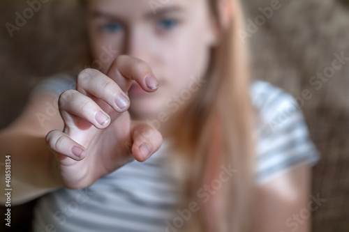 The girl shows her hand with dirty nails to the camera. Hand hygiene for children at home. photo