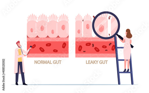 Comparison of Normal and Sick Gastrointestinal Tract Tissue, Leaky Gut Syndrome. Healthy and Inflamed Intestinal Cells