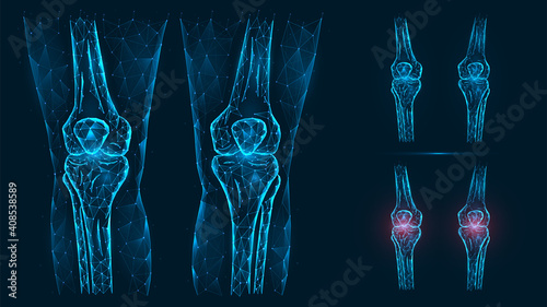 Abstract polygonal illustration of human knee anatomy. Disease, pain and inflammation of the knee joints isolated on blue background.