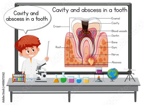 Young scientist explaining cavity and abscess in a tooth in laboratory