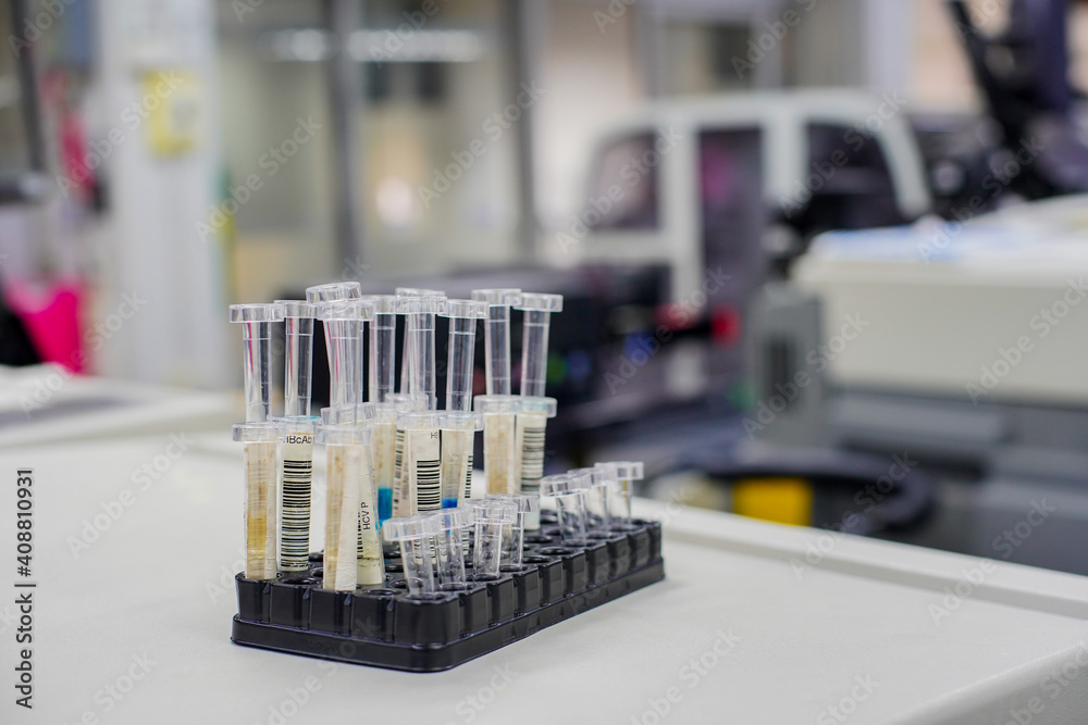 Blood test tubes in modern science laboratory at the hospital.