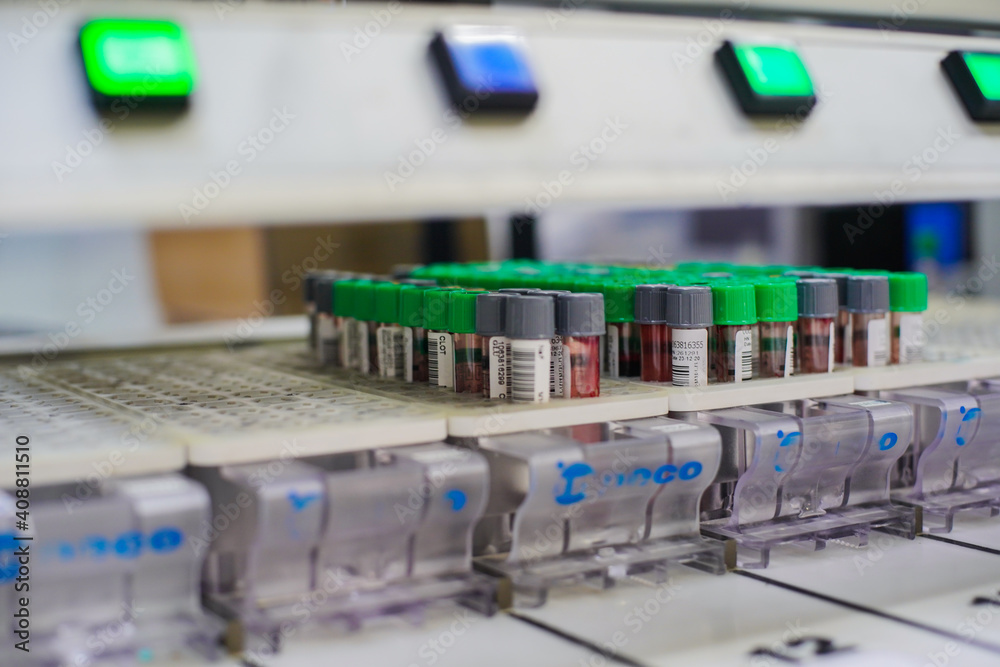 Blood test tubes in modern science laboratory at the hospital. Blood test tubes in modern science laboratory at the hospital.