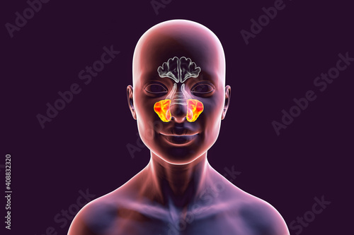Anatomy of paranasal sinuses photo