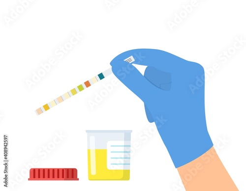 Hand in white glove holding urine strip for diagnosis urinary tract infection isolated on white background. Medical examination. Vector illustration in flat style