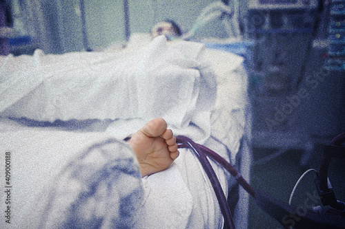 Patient in the ICU connected to mecanical ventilator and hemodialysis apparatus photo