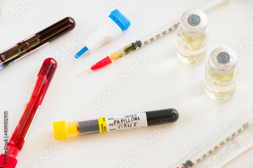 Papilloma virus blood test tube sample on the white background in the laboratory