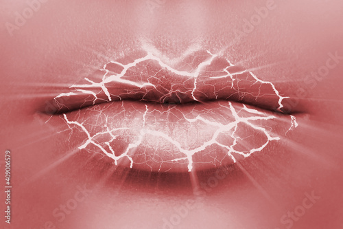фотографія Closeup of chapped lips with a cracks
