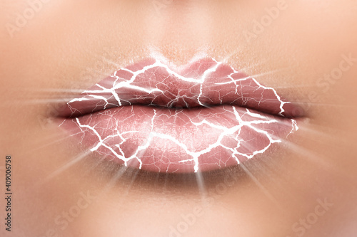 фотографія Closeup of chapped lips with a cracks