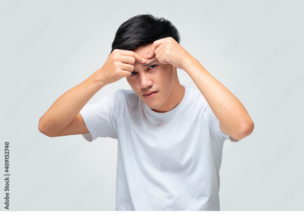 A handsome young Asian man squeezes a pimple on his forehead. A handsome young Asian man squeezes a pimple on his forehead.