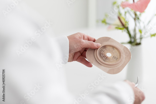 an ostomy therapist prepares an ostomy pouch photo