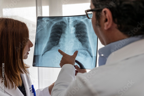 two doctors read a chest x-ray photo