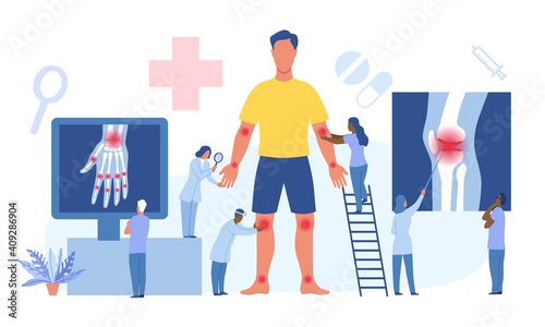 Elbow, knee, ankle arthritis concept. Man patient suffering from joint pain. Tiny doctors examining xray pictures of joints in doctor office. Osteoarthritis, rheumatoid arthritis. Vector illustration