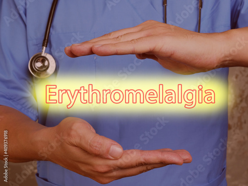 Conceptual photo about Erythromelalgia with written text. photo