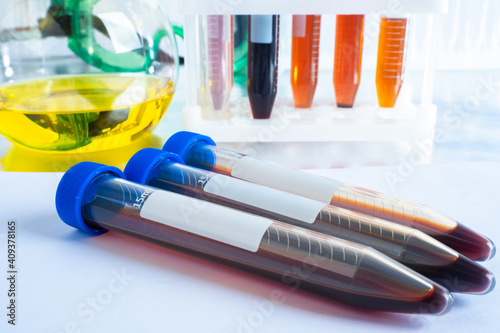 Blood donation tubes. Test ...