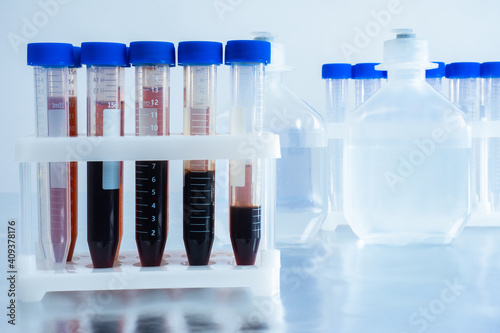 Test tube blood is on table...